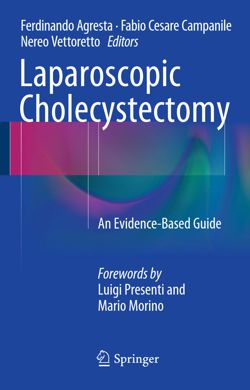 Laparoscopic Cholecystectomy - An evidence-based Guide